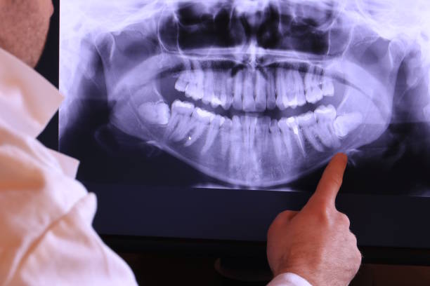 Fast & Reliable Emergency Dental Services in ID