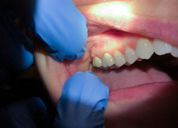 Best Emergency Treatment for Toothache in Garden City, ID